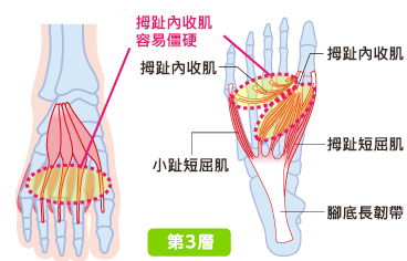 母趾内転筋は凝り固まりやすい
